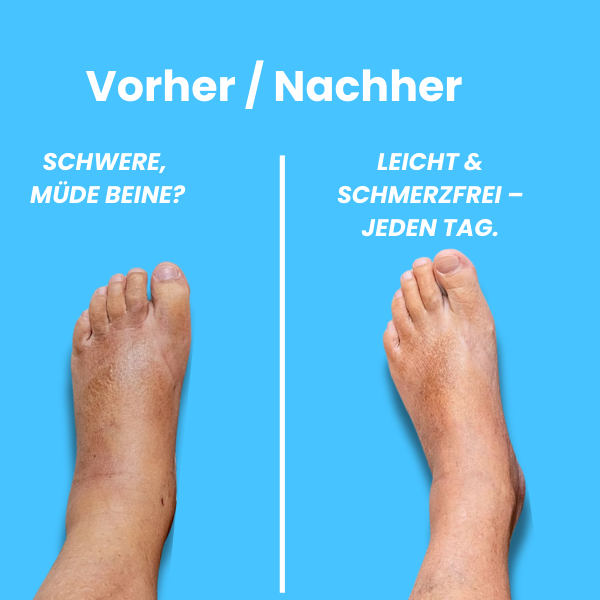 Orteva® ZipKomfort Kompressionsstrümpfe